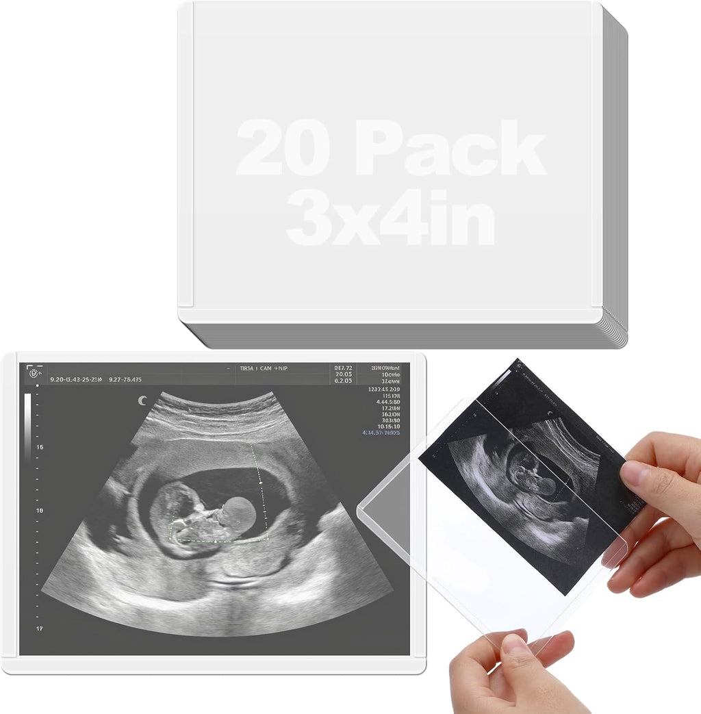Easy-Slide Photocard Sleeves Photo Protector for 3x4in Ultrasound Pictures