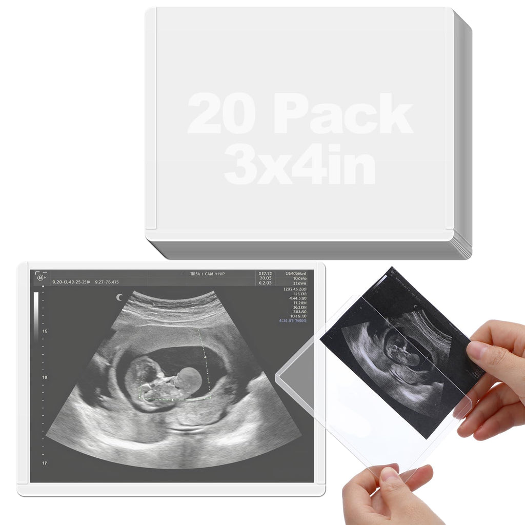 Easy-Slide Photocard Sleeves Photo Protector for 3x4in Ultrasound Pictures