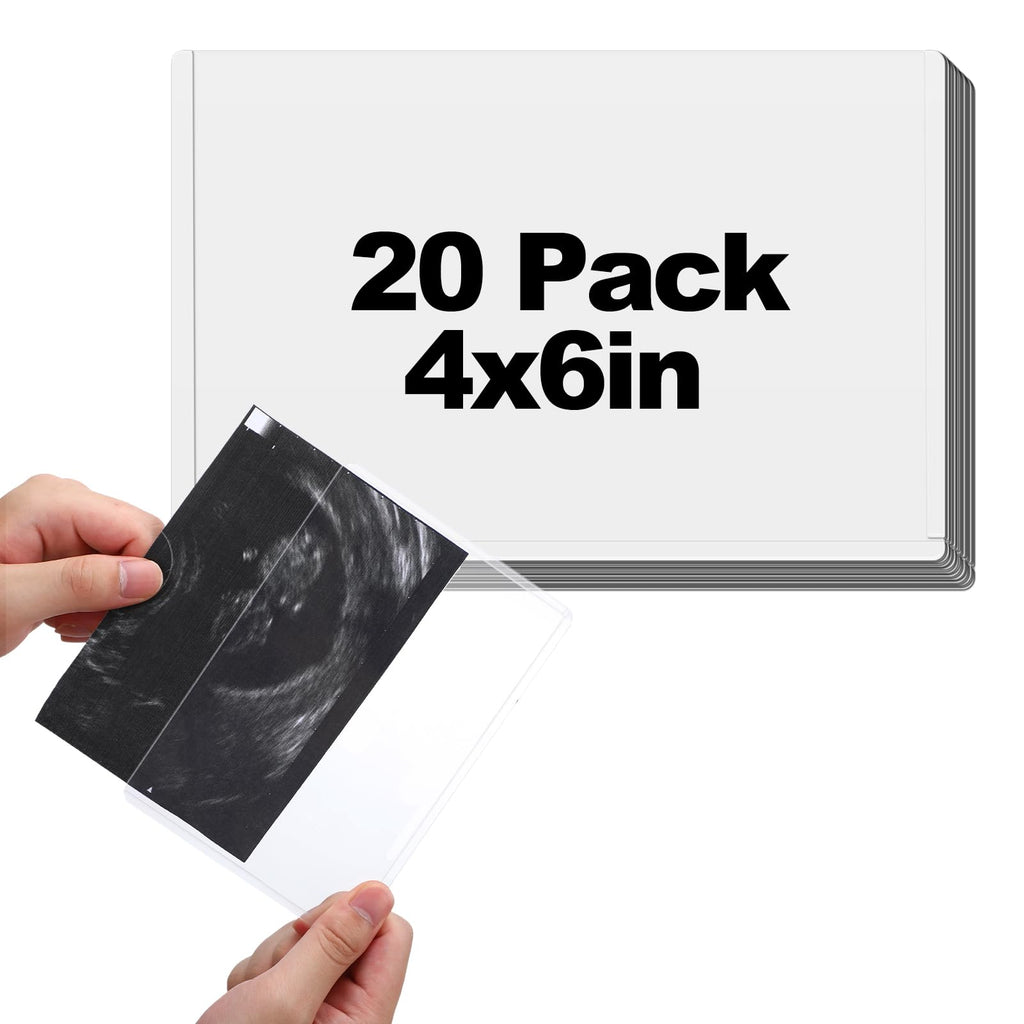 Easy-Slide Photocard Sleeves Photo Protector for 3x4in Ultrasound Pictures
