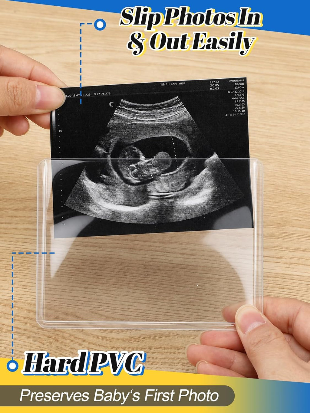Easy-Slide Photocard Sleeves Photo Protector for 3x4in Ultrasound Pictures